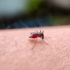 सांकेतिक तस्वीर: त्वचा पर बैठा मच्छर